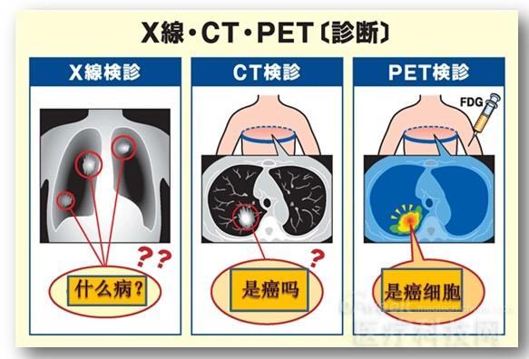PET和PET-CT的区别 - OFweek医疗科技网