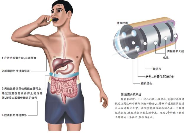 【前沿】胶囊机器人将终结"胃肠镜恐惧"?路还很长