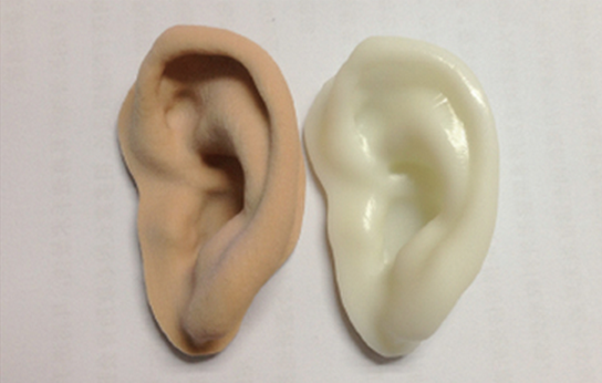 3D打印技术在精细个性化耳再造手术中的应用