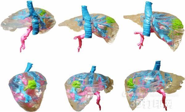 波兰创建低成本彩色肝脏3D打印模型-波兰创建