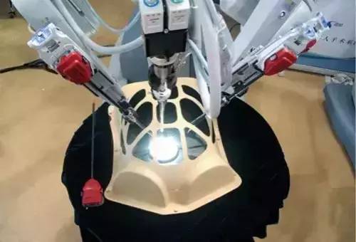 你敢让机器人给你做手术吗？