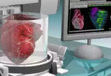 3D器官打印将成为生物治疗的新突破点