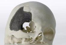 3D打印在生物医用材料领域应用展望