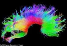 生物识别新进展：可以分析大脑区分双胞胎