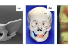 深度解析：3D打印骨组织工程支架研究